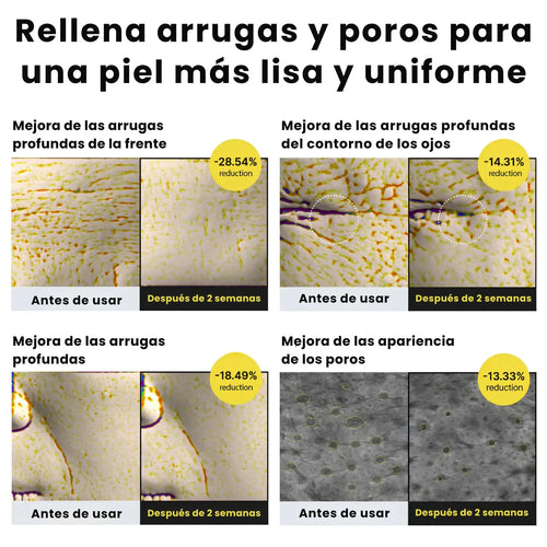 Celimax Retinal Shot